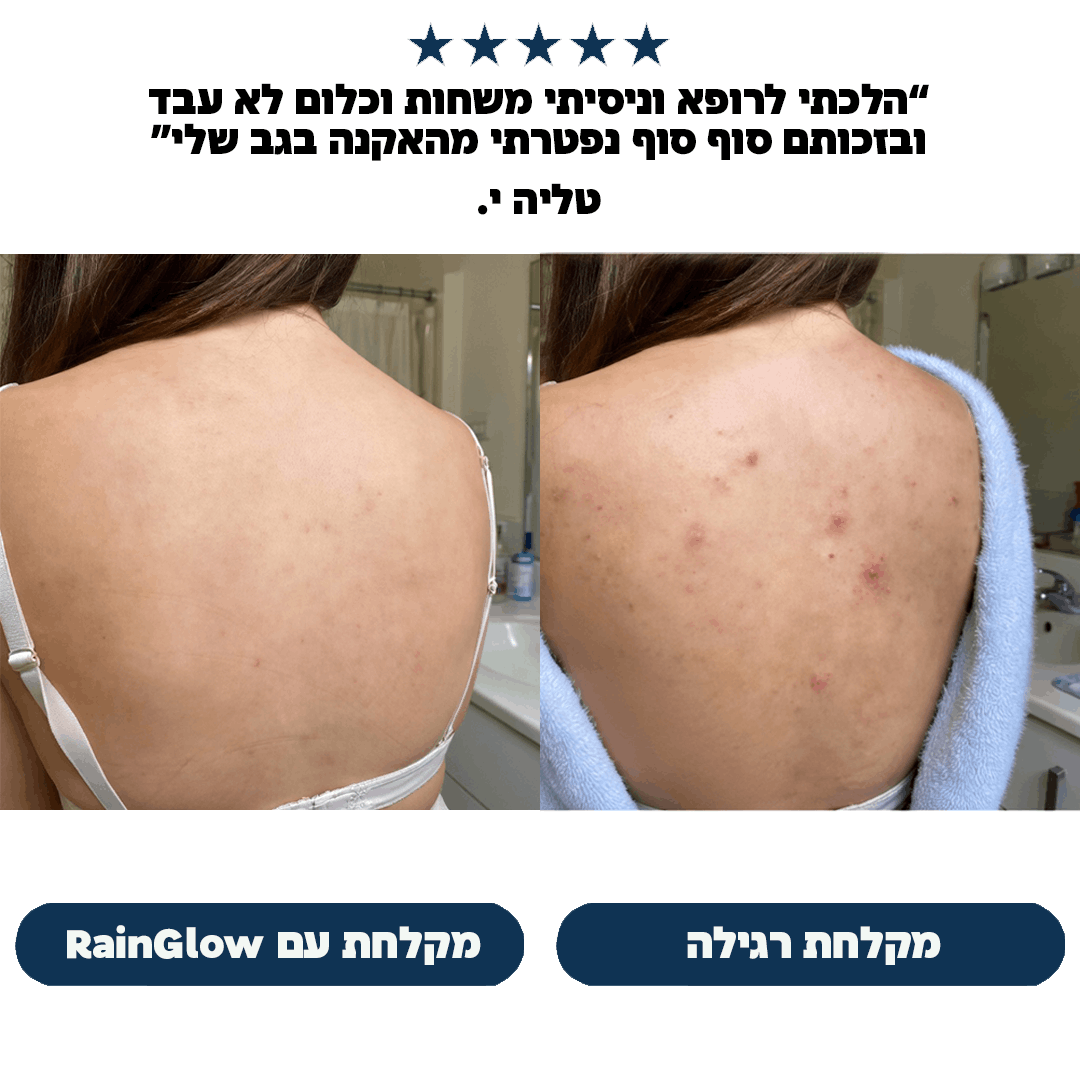 RainGlow | ראש מקלחת עם פילטר ומינרלים למים נקיים יותר עבור העור והשיער