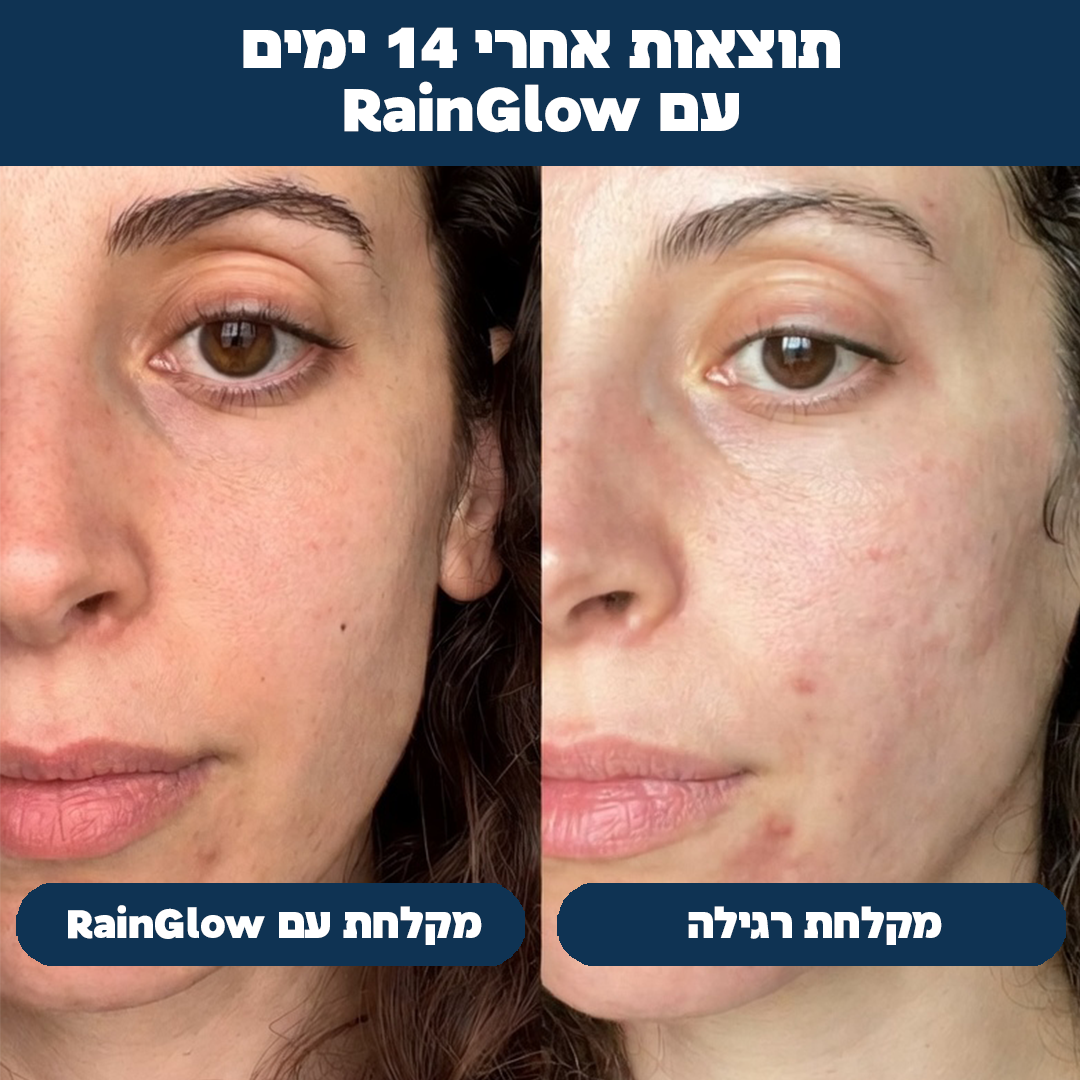 RainGlow | ראש מקלחת עם פילטר ומינרלים למים נקיים יותר עבור העור והשיער